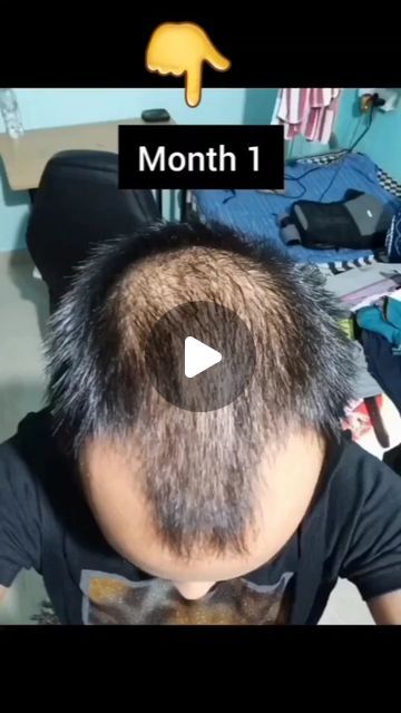 Pihu officials on Instagram: "100%Re-Growth Hair Challenge/Hair Fall Control Tips   . . . . . #hairfall #hairfallcontrol #hairfallcontroltips #regrowthhair #haircare #haircareroutine #instagram #trending #viralreels #instagramreels" Hair Fall Control Remedies Home, Hairfall Control Remedies, Hairfall Remedies Home, Healthy Hair Growth Remedies, Hairfall Solution, Hair Fall Remedy Home, Hair Fall Men, Hair Oil Ingredients, Hair Fall Control Tips