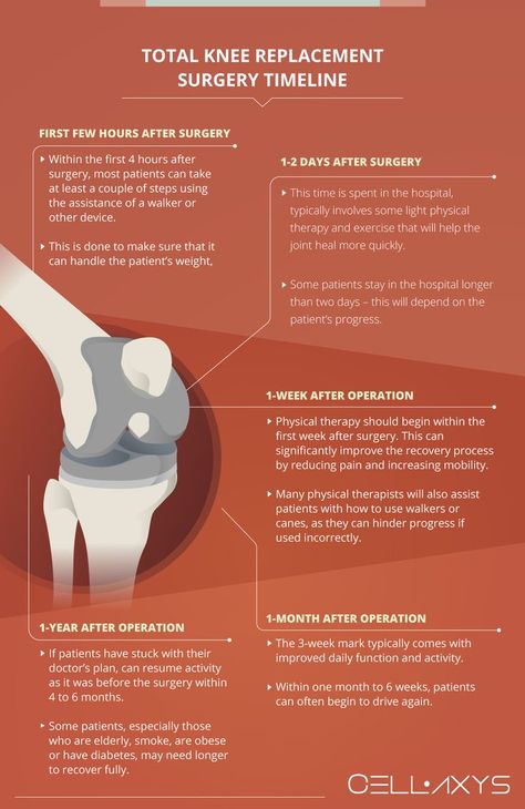 Total Knee Replacement Surgery Timeline Knee Replacement Surgery Recovery, Knee Replacement Recovery, Knee Surgery Recovery, Knee Replacement Surgery, Last Resort, Knee Up, Knee Surgery, Knee Replacement, Surgery Recovery