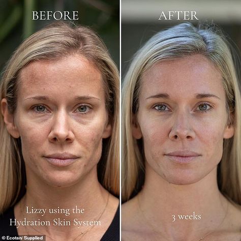 Eco Tan by Sonya Driver: Organic hydration system transforms skin in 21 days | Daily Mail Online Eco Tan, Skin System, Caviar Lime, Tan Face, Acne Free, Skin Issues, New Skin, Organic Oil, 21 Days