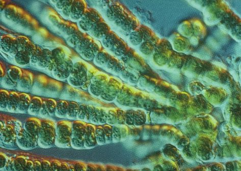 Blue-Green Algae - Cyanobacteria Microscopic Algae, Blue Algae, Improve Your Memory, Marine Algae, Blue Green Algae, Soy Beans, Green Algae, Bio Art, Charles River