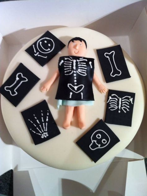 Radiology X ray cake Radiology Cake, Funny Emoticons, Mini Cakes Birthday, Graduation Cakes, Radiology, Birthday Surprise, Cookie Cake, Cake Creations, Mini Cakes