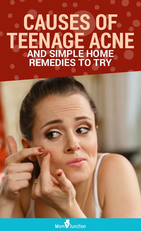 Acne is a common problem among teenagers and often leaves them self-conscious. Your teenager may try all possible home remedies to get rid of the annoying acne or at least make them insignificant. Face Mask For Teenage Acne, Tips To Reduce Acne, Natural Remedies For Cystic Acne, Active Acne Remedies, How To Clear Pimples, Acne Scaring, Teenage Acne, Home Remedies For Pimples, Acne Help