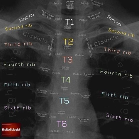 Spine Xray, Radiology Schools, Medical Radiography, Radiology Student, Radiology Technician, Nursing Information, Medical School Life, Radiology Technologist, Medical School Studying