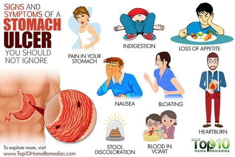 signs and symptoms of a stomach ulcer you should not ignore Stomach Ulcers Symptoms, Ulcer Symptoms, Top 10 Home Remedies, Reflux Disease, Stomach Ulcers, Health Life, Stomach Pain, Hormone Imbalance, Acid Reflux