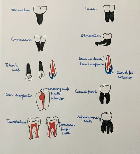 Pathology Aesthetic, Oral Pathology, Health Dinner, Cleanse Recipes, Dental Hygiene, Home Remedies, Science, Memes, Quick Saves