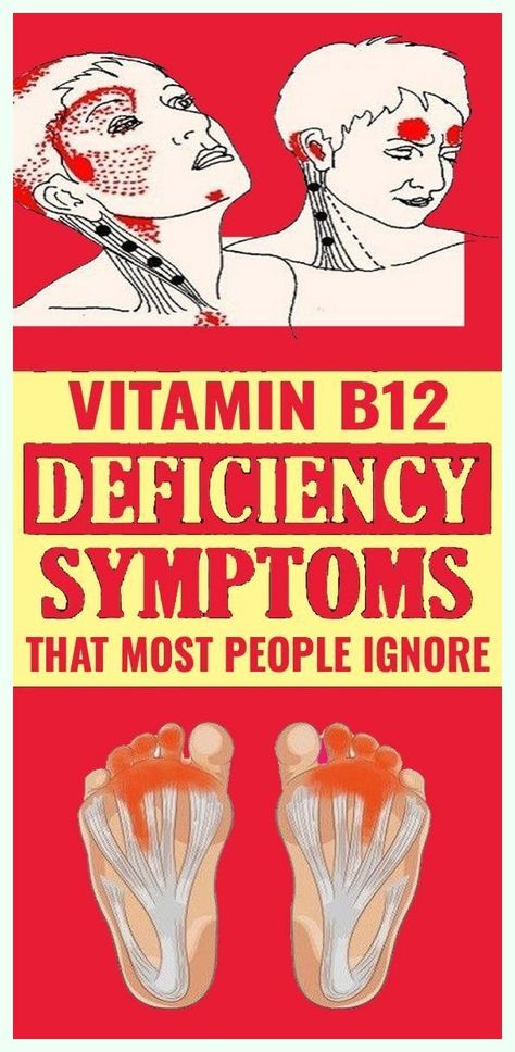 5 Warning Signs of Vitamin B12 Deficiency You Should Never Ignore Vitamin D Deficiency Symptoms, B12 Deficiency Symptoms, Deficiency Symptoms, B12 Deficiency, Vitamin B12 Deficiency, Vitamin D Supplement, Vitamin D Deficiency, Nutrition And Dietetics, Simple Graphic