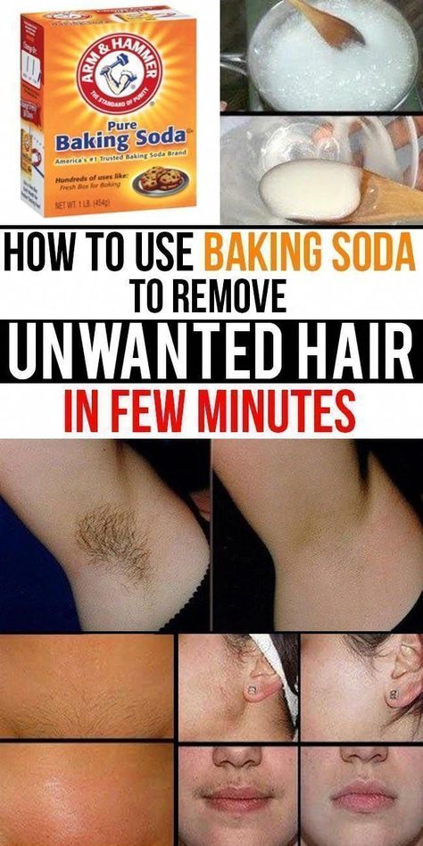 Unwanted Hair Removal Methods You Can Try at Home #HomeRemediesforUnwantedHair #UnwantedHairRemovalWithLaser #ChinHairRemoval #LegHairRemoval Best Permanent Hair Removal, Chin Hair Removal, Permanent Hair Removal Cream, Permanent Facial Hair Removal, Back Hair Removal, Electrolysis Hair Removal, Lip Hair Removal, Ingrown Hair Removal, Best Hair Removal Products