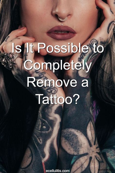 Is it possible to remove an entire tattoo? The answer is yes, but not every time. Let’s take a look at the factors that play a role in the tattoo removal process. At Home Tattoo Removal, Tatto Designs, Positivity Tattoo, Button Tattoo, Deep Tattoo, Tattoo Removal Cost, Beginner Tattoos, Biker Tattoos, Laser Removal