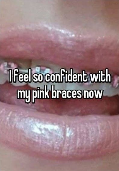 Pink Braces, Cute Braces Colors, Braces Tips, Getting Braces, Cute Braces, Brace Face, Braces Colors, Vision Board Affirmations, Barbie Dream