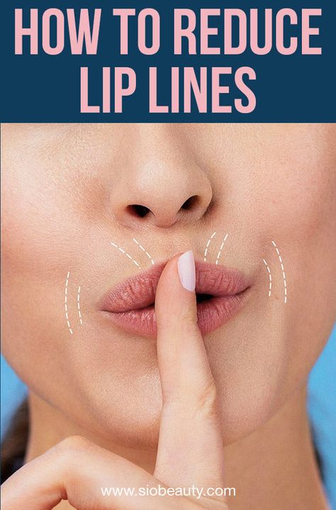 Skincare: Lip Lines, this is what you can do to reduce lines and wrinkles on your upper lip or around the mouth. Upper Lip Wrinkles, Skin Care Procedures, Smokers Lines, Mouth Wrinkles, Acne Prone Skin Care, Lotion For Oily Skin, Tips For Oily Skin, Lip Wrinkles, Skin Care Wrinkles