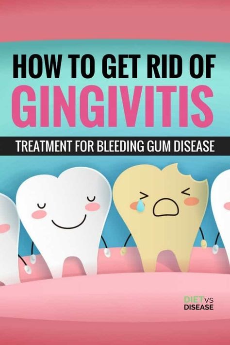 Swollen Gums Remedy, Homemade Mouthwash, Gum Inflammation, Heal Cavities, Swollen Gum, Teeth Whitening Diy, Teeth Health, Receding Gums, Gum Care