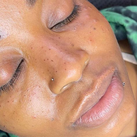 Freckles Tattoo, Freckle Tattoo, Tattooed Freckles, Cosmetic Tattooing, Fake Freckles, Faux Freckles, Heavy Makeup, Traditional Ink, Natural Henna