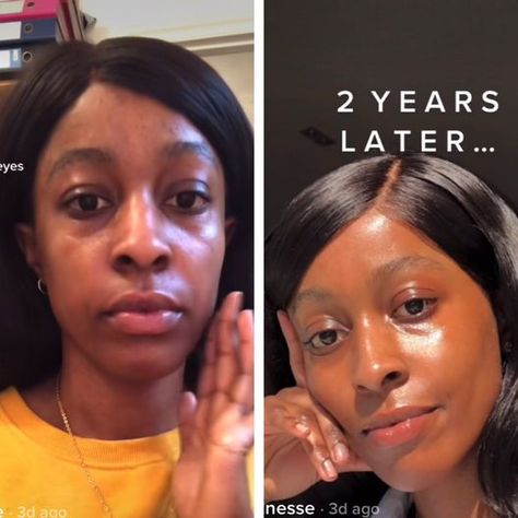 Be Amazed at this Before and After Gua Sha Facial Transformation. — BELLEMOCHA.com Face Transformation, Botox Before And After, Celebrity Beauty Secrets, Social Media Feed, Gua Sha Massage, Facial Toning, Diy Skin Care Routine, Gua Sha Facial, Skincare Inspiration