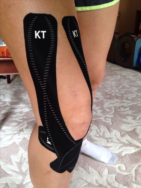 KT Tape! Saving my knee...no pain or locking yet!! :) More Kt Tape Knee, K Tape, Kt Tape, Kinesio Taping, Ginger Benefits, Kinesiology Taping, Knee Pain, Physical Therapy, Health Problems