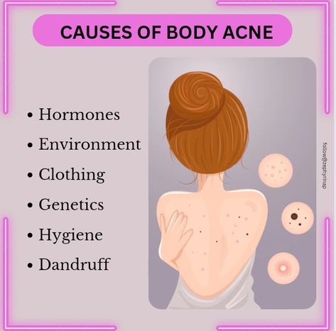 Back Acne Remedies, Facial Massage Techniques, Blind Pimple, Back Acne, Pimples Under The Skin, Warm Compress, Body Acne, Wax Strips, Skin Pores