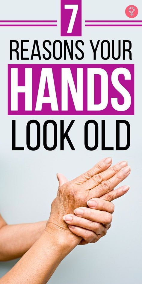 7 Reasons Your Hands Look Old: You have to devote as much time to taking care of the delicate, overused skin of your hands as you do of your face. Here are 7 things that give your hands an aged appearance and what you can do to fix them. #hands #skin #skincare #old #beauty #beautytips Remove Super Glue, Natural Wrinkle Remedies, Wrinkles Hands, Anti Aging Hands, Wrinkle Remedies, Wrinkle Free Skin, Get Rid Of Warts, Luxurious Spa, Face Wrinkles