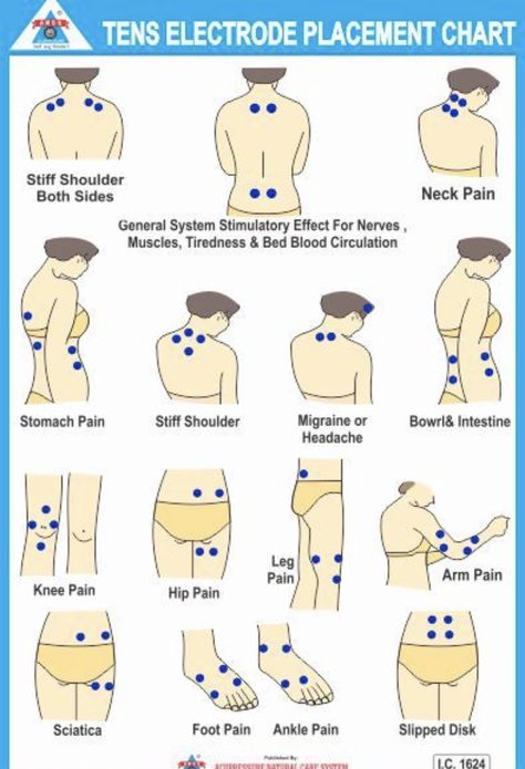 Tens Placement, Tens Electrode Placement, Tens Unit Placement, Forward Head Posture Exercises, Full Body Massage Techniques, Tens Machine, Cupping Massage, Tens Unit, Massage Therapy Techniques