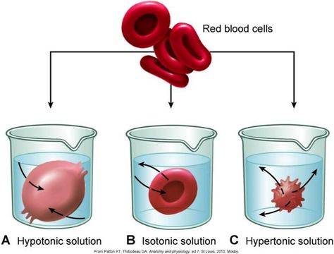 There are three types of osmosis hypotonic, hypertonic, and isotonic. These are the effects of different solutions on blood cells. This picture is of the osmotic pressures on blood cells. Isotonic Hypotonic Hypertonic, Osmotic Pressure, Study Biology, Biology Classroom, Basic Anatomy And Physiology, Medical Laboratory Science, Study Flashcards, Chemistry Lessons, Biology Lessons