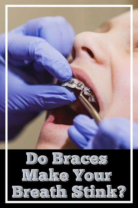 Wearing braces can cause your breath to stink. This embarrassing odor is entirely preventable and avoidable. If you have braces, you must relearn how to clean your teeth... . #teeth #braces #smell #smelly #scent #odor #fresh #hygiene #dentalhygiene #badbreath Causes Of Bad Breath, Body Care Recipes, Gum Inflammation, Bad Breath Remedy, Proper Hygiene, Teeth Braces, Periodontal Disease, Natural Body Care, Skin Care Remedies