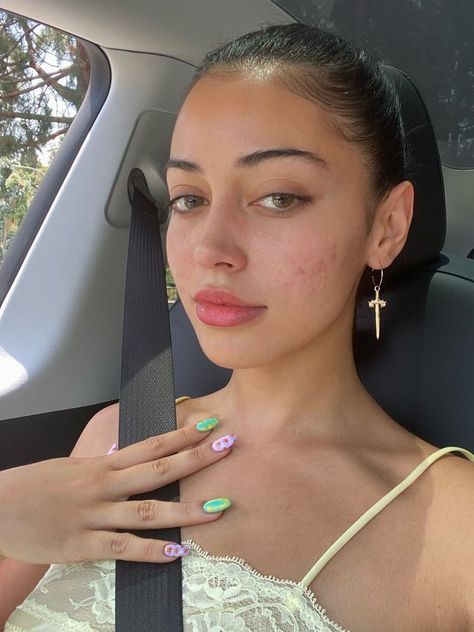 Girl With Acne, Marks Cream, Cindy Kimberly, Bare Beauty, Bare Face, Facial Skin Care Routine, Love Your Skin, Pretty Skin, Acne Marks