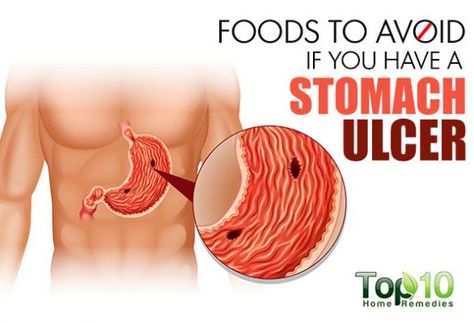 Foods to Avoid if You Have a Stomach Ulcer Food For Stomach Ulcers, Stomach Ulcers Symptoms, Chrones Disease, Ulcer Symptoms, Ulcer Diet, Acid Reflux Friendly Recipes, Top 10 Home Remedies, Stomach Ulcers, Improve Gut Health