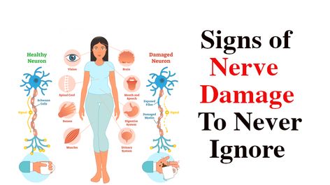 Nerves In Back, Nerve Pain Remedies, Nerve Problems, Brain Nerves, Muscle System, Muscle Twitching, Spinal Nerve, Pinched Nerve, Nerve Pain Relief