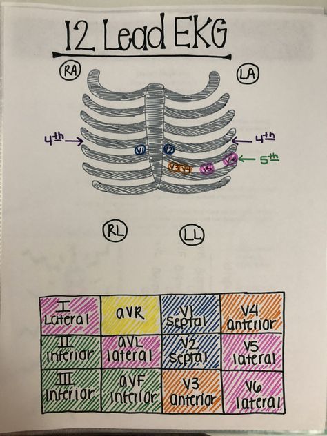 Medical Assistant School, Medical Assistant Student, Paramedic School, Student Notes, Nurse Study Notes, Nursing Mnemonics, Medical Student Study, Nursing School Survival, Nursing School Studying