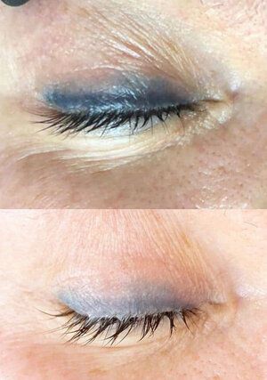 Eyelash Enhancement Tattoo, Remove Eyebrow Tattoo, Laser Tattoo Removal Eyebrows, Lazer Removed Tattoo Before And After, Eyebrow Tattoo Removal, Tattoo Removal Cream, Cream Tattoo, Semi Permanent Eyeliner, Laser Removal