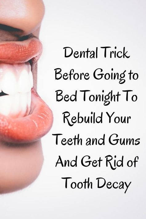 Simple 20 Second Trick Turns Back Years Of Tooth Decay.Do This 60 Seconds Dental Trick Before Going to Bed Tonight To Rebuild Your Teeth and Gums.Click the link and watch the full video.#toothdecay #toothproblem #WhatAreOralCare #WhatIsOralCare #HowToCareForOralHealth #WhyOralCareIsImportantForElderly #OralDentalCare#dentist Fix Teeth, Reverse Cavities, Pasta Dental, Teeth Health, Stronger Teeth, Before Going To Bed, Receding Gums, Oral Care Routine, Going To Bed