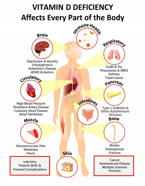 Interactive PDF: How Vitamin D Deficiency Affects Every Part of the Body - GrassrootsHealth Skin Bumps, Vitamin D Supplement, Vitamin D Deficiency, The Human Body, Autoimmune Disease, Vitamin D, Vitamins And Minerals, Personal Trainer, Disease