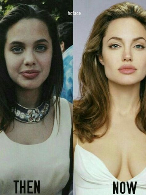 Did Angelina Jolie ever say anything about plastic surgery? Angelina Jolie Modeling, Angelina Jolie Surgery, Angelina Jolie Nose, Angelina Jolie Plastic Surgery, Celebs Without Makeup, Angelina Jolie Photos, Celebrities Then And Now, Celebrity Plastic Surgery, Celebrities Before And After