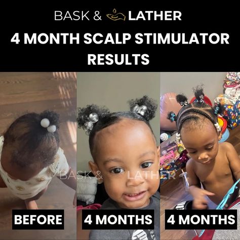 4 months before using our hair growth products, this baby girl was struggling to grow her hair. Her mother felt helpless but Bask and Lather came through 💛🙌🏾 . . . . #hairtransformations #kidshairstyles #beforeandafterhair #hairoftheweek #haircare #baskandlatherco Baby Hair Moisturizer, Grow Baby Hair, Baby Hair Growth, 5 Month Baby, Hair Growth Products, Growth Oil, 4c Hairstyles, Moisturize Hair, Hair Growth Oil