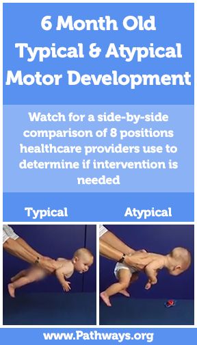 There are subtle signs in baby’s movements that may indicate a physical development delay. Watch two children at 6 months old, in eight different positions. One baby shows typical development at 6 months while the other shows atypical movements. Copyright © 2018 Pathways Foundation Baby Development In Womb, Teething Chart, Baby Development Chart, Glenn Doman, Comparison Video, 2 Month Old Baby, Baby Development Activities, Development Milestones, Pediatric Physical Therapy