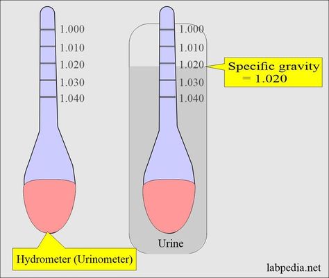 Renal Function Tests Sample for Renal Function Tests A fresh serum is needed. Fresh urine is also needed. To assess renal function, the following tests or parameters are advised. For concentration and Dilution, advise Specific gravity (Sp. Gr). Specific gravity It is the measure of the concentration of particles, including waste products and electrolytes, in the urine. The definition of specific gravity is the weight of the urine compared to that of distal wate... Urine Analysis, Clinical Laboratory, Nephrotic Syndrome, Cardiac Disease, Biomedical Science, Body Fluid, Preventative Health, White Blood Cells, Urinary Tract