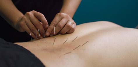 #AdvancedHealth Chiropractor in #Preston is conveniently located on Plenty Rd (Preston, Thornbury border) – providing quality care to those in #Preston, Thornbury, #Northcote, and #Reservoir Needling Therapy, Dry Needling Therapy, Remedial Massage, Dry Needling, Chiropractic Clinic, Lower Back Muscles, Chronic Condition, Muscle Recovery, Physical Therapist