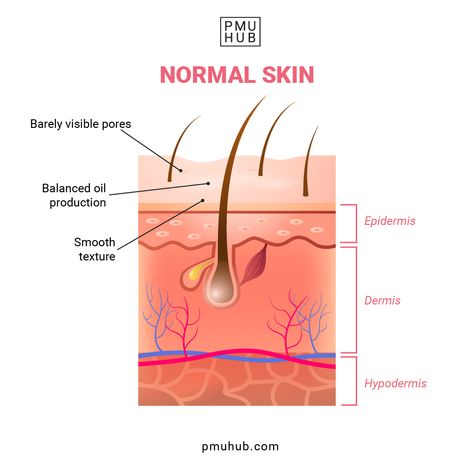 normal skin, how to determine your skin type, skin types Layers Illustration, Combination Skin Routine, T Zone, Skin Anatomy, Forehead Acne, Oily T Zone, Skin Layers, Normal Skin Type, Skin Burns