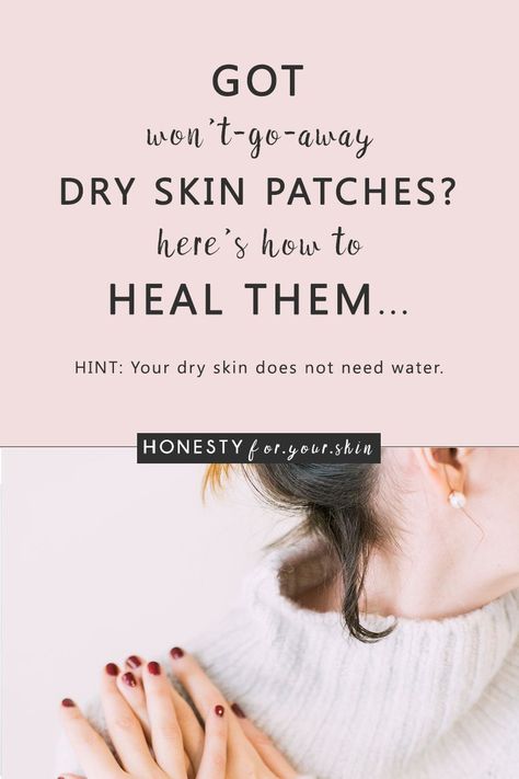 Dry skin patches are oh so irritating... especially when they happen on your face. They look flaky, red and can be sensitive. They can suck your confidence. Clump your foundation. Be painful, itchy and ageing. Dry skin patches are a sign your skin health is low. Do nothing and your dry skin patches will get worse. Choose to take action and your skin health battery can be happily topped back to full. Want to know how? Come learn all my friend... Flaky Skin On Face, Dry Patchy Skin, Patchy Skin, Dry Flaky Skin, Dry Skin On Face, Skin Balm, Dry Skin Remedies, Skin Patches, Dry Skin Patches