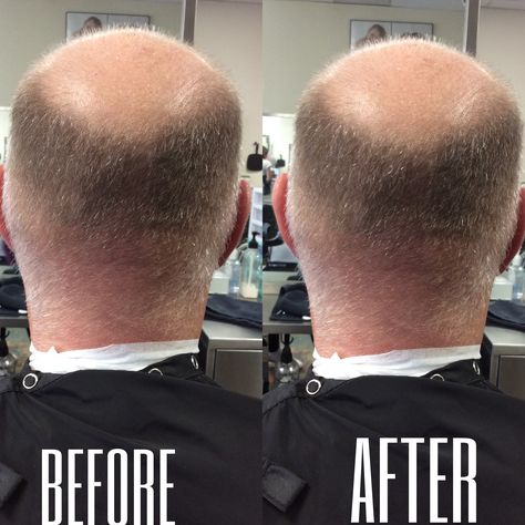 Men's haircut using #1 guard all over and tapered in the nape  12/2/16 #tressesbyannabelle One Blade Razor, Clipper Lengths, Best Curly Hairstyles, Clipper Cut, Formula 4, Best Bob Haircuts, Haircut Pictures, Men's Haircuts, Strawberry Blonde Hair