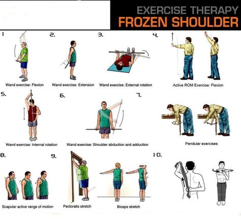 Physical Therapy for Pain Relief From Frozen Shoulder Shoulder Exercises Physical Therapy, Frozen Shoulder Exercises, Shoulder Rehab Exercises, Rotator Cuff Exercises, Chiropractic Therapy, Shoulder Rehab, Isometric Exercises, Rehabilitation Exercises, Shoulder Exercises