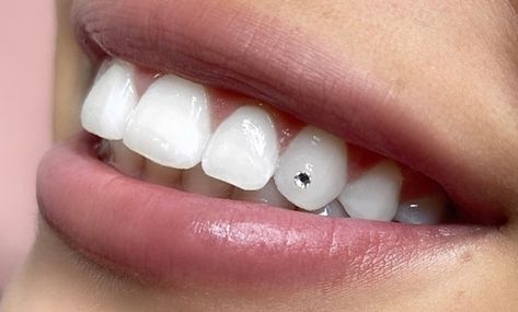 You've most likely heard of ear, body, and oral piercings. How about a tooth piercing? This fashion involves pinning a gem, stone, or other jewelry to a tooth in your mouth.

While the procedure might brighten your smile, it involves some risks.

Read on to understand more about tooth piercing and the associated risks. Tooth Piercing, Teeth Stone, Tooth Gems Ideas, Celebrity Teeth, Loose Teeth, Eyebrow Embroidery, Diamond Teeth, Tooth Gems, Eyelash Enhancer