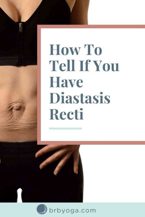 How Do You Know If You Have Diastasis Recti, How To Check For Diastasis Recti, How To Fix Diastasis Recti Years Later, How To Fix Diastasis Recti Abdominal Muscles, Diastasis Recti Symptoms, Diastasis Recti Exercises To Avoid, Diastasis Recti Yoga, Diastis Recti, Diasis Recti