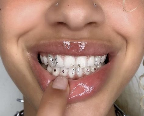 Teeth Gems, Dental Jewelry, Pretty Teeth, Grillz Teeth, Diamond Teeth, Grills Teeth, Tooth Gems, Tooth Gem, Gold Teeth