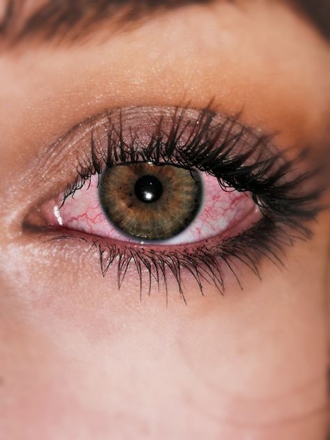 Alcoholic Eyes, Eye Veins, Blood Shot Eyes, Zombie Oc, Bloodshot Eyes, 17th Birthday Ideas, Red Veins, Irritated Eye, Eye Illustration