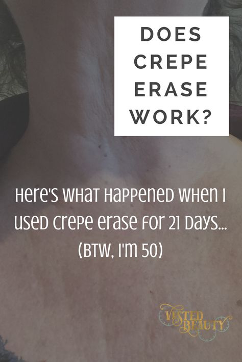 Thinking about buying Crepe Erase? Here's how it worked on my neck and decolletage after 21 days. Oh, and I'm 50 and have good genes. Also, how to save money on it! Men Anatomy, Haircut Mens, Crepe Skin, Crepe Erase, Hairstyles Mens, Prostate Health Men, Diets For Men, Aesthetic Men, Men Health