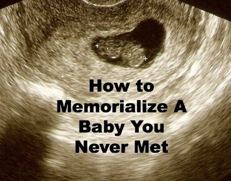 If you're looking for a way to memorialize a baby you never met, this post provides a really neat idea. A beautiful way to remember a miscarried baby. Unborn Baby Quotes, Remembering Baby, Angel Baby Quotes, Baby Remembrance, Losing A Baby, Unborn Baby, Pregnancy Loss, Baby Tattoos, Infant Loss