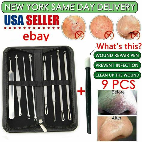 Using this remover tool is one of the safest ways to clear your pores, rather than squeezing blackheads using your fingernails. It will also lessen trauma to the surrounding skin. Type: Acne Extractor Set. Pimple Extraction Tool, Promoted By Amazon, Squeezing Blackheads, Acne Tool, Removing Blackheads, Pimple Extractor, Blind Pimple, Pimples Under The Skin, Comedone Extractor