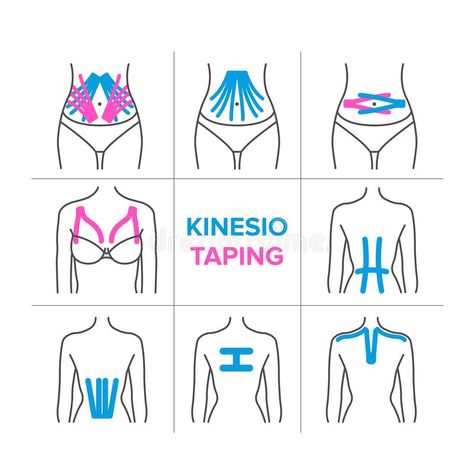 The kinesiology taping vector illustration Back Taping, Physio Tape, Diástase Abdominal, K Tape, Kinesio Tape, Kt Tape, Massage Therapy Techniques, Kinesio Taping, Kinesiology Taping