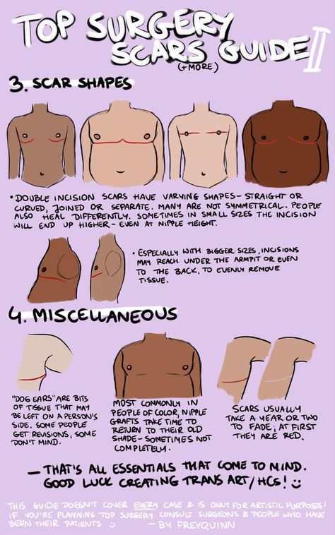 Top Surgery Scars, Top Surgery, Trans Art, Trans Boys, Losing 40 Pounds, Cold Sores Remedies, Lose 40 Pounds, Body Reference, Art Tips