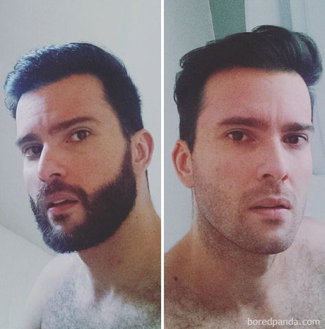 Before And After Shave Beard And Shaved Head, Shaved Head Bearded Men, Shaved Head With Mustache, Beard Before And After, Mustache And Chin Beard, Body Plastic Surgery, Neck Beard, Shaved Head With Beard, Soul Patch