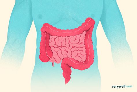 The sigmoid colon normally helps stool transit out the last part of the large intestine. This article describes functional impairments and pain symptoms. Colon Problems, Rectal Prolapse, Sigmoid Colon, Abdominal Discomfort, Healthy Morning Routine, Irritable Bowel, Health Habits, Abdominal Pain, Weight Management